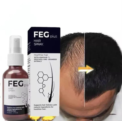 FEG Plus Hair And Beard Regrowth Spray Anti Hair Loss Formula With Minoxidil Redensyl And Natural Extracts - 50ML